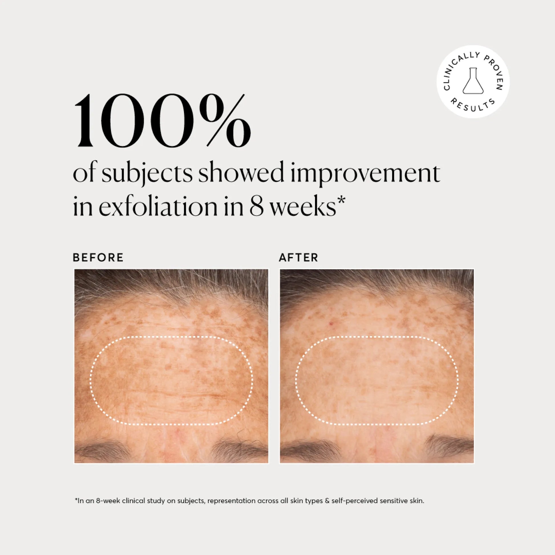 bha-liquid-exfoliant-2-y6 NATR-10027-Alt-Images-BHA-Liquid-Exfoliant-2_-03.webp